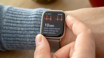 Apple Watch ECG