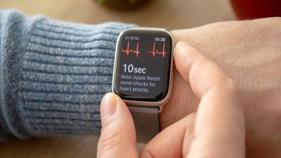 ECG Apple Watch