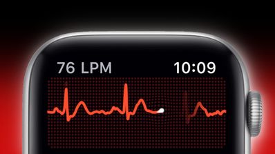 ecg apple watch