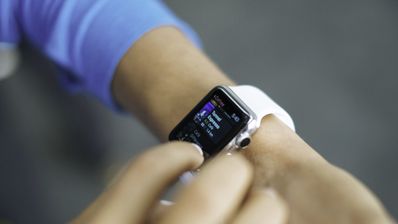 apple watch brazo uso