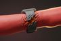 Representación conceptual de un brazo enrojecido con un reloj inteligente cuya correa parece agrietar la piel.