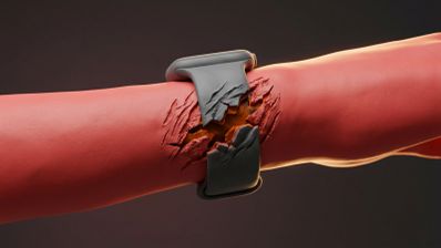 Representación conceptual de un brazo enrojecido con un reloj inteligente cuya correa parece agrietar la piel.