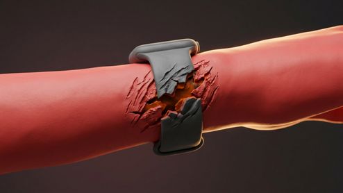 Representación conceptual de un brazo enrojecido con un reloj inteligente cuya correa parece agrietar la piel.