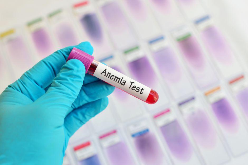 Test Anemia